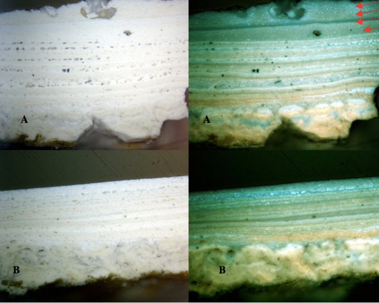 Paint stratigraphy under normal and UV light both before (above) and after removing the latex overburden. Richard Wolbers, 2010.